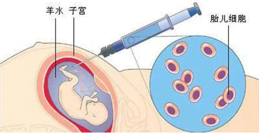 孕期做胎儿亲子鉴定合适吗？孕期有哪些胎儿亲子鉴定方法？